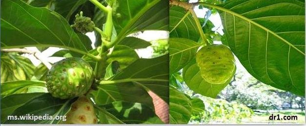 Cer Cuba Petua Sakit Kaki Ni