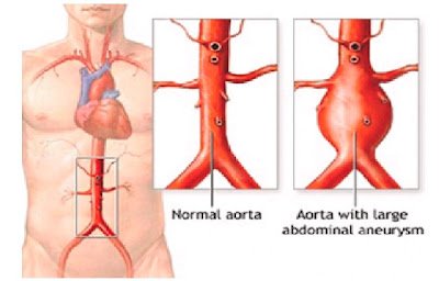 blog-apa-aja.blogspot.com