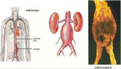 blog-apa-aja.blogspot.com