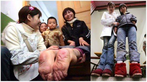 Miliki Tapak Kaki Terbalik.